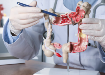 More young adults are being diagnosed with gastrointestinal cancers