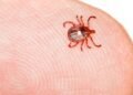 Rare tick-bite allergy leaves Nova Scotia woman unable to eat meat or dairy