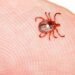Rare tick-bite allergy leaves Nova Scotia woman unable to eat meat or dairy