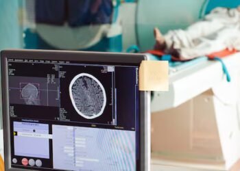 Albertans can pay for MRIs and other tests without a doctor’s referral, as of Friday