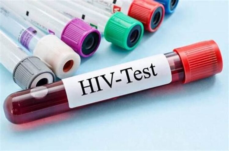 AIDS Secretariat Urges Safer Sexual Practices During Antigua Carnival
