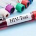 AIDS Secretariat Urges Safer Sexual Practices During Antigua Carnival