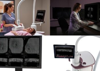 Breast ultrasound machine sought to cut wait times, improve detection