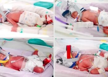 The birth in Australia of identical quadruplets