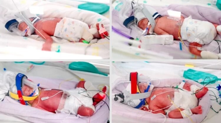 The birth in Australia of identical quadruplets