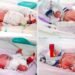 The birth in Australia of identical quadruplets