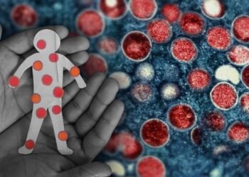 Mpox case confirmed in Mandaluyong; contact tracing launched