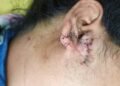 Gurugram woman says she was shot at during July 20 protest