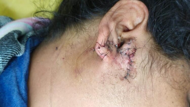 Gurugram woman says she was shot at during July 20 protest
