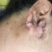 Gurugram woman says she was shot at during July 20 protest