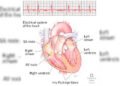 Is your heart racing or skipping beats? Learn when it could be an arrhythmia