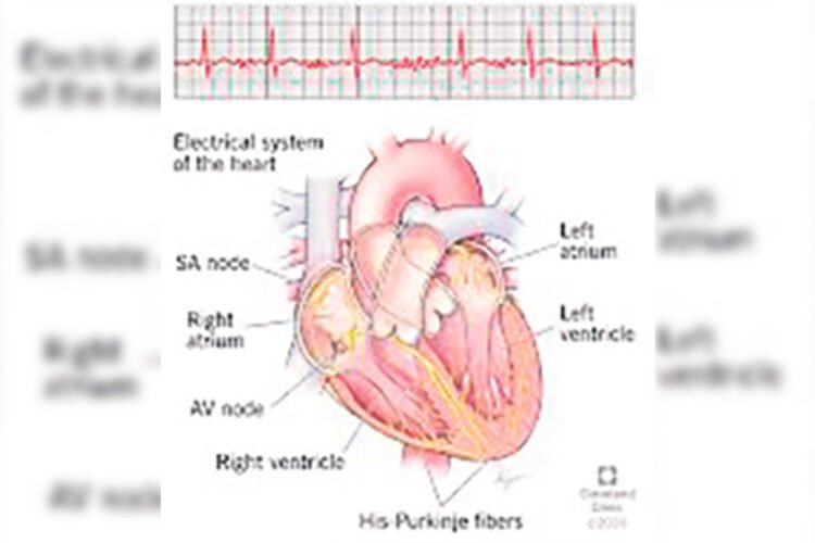 Is your heart racing or skipping beats? Learn when it could be an arrhythmia