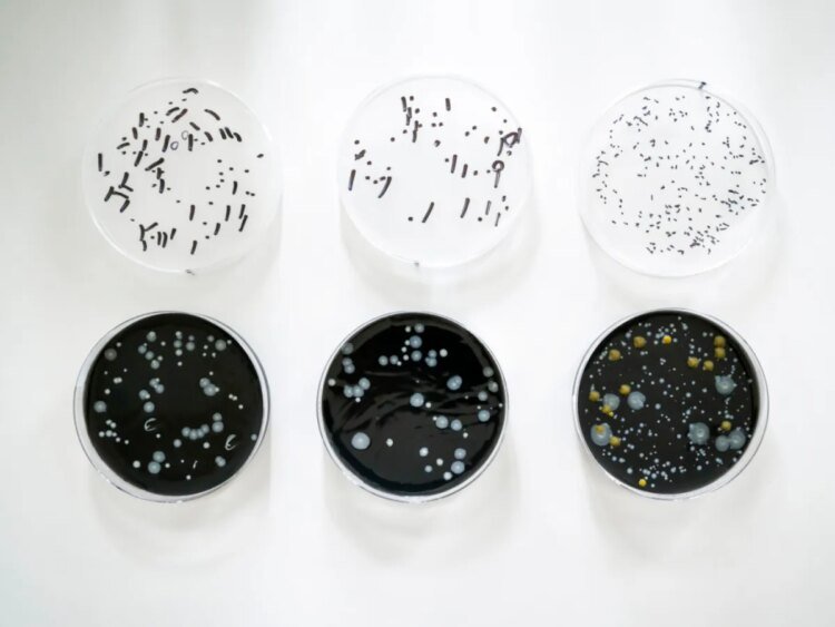 Two new cases of Legionnaires’ disease in Switzerland