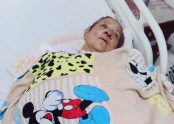 Canter driver blames motorist after Venezuelan woman struck down in Bartica