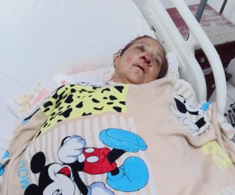 Canter driver blames motorist after Venezuelan woman struck down in Bartica