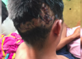 Guinea Grass Man Survives Crocodile Attack at New River Park