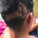 Guinea Grass Man Survives Crocodile Attack at New River Park