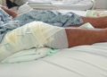 Farmer Says He Was Shot First, Now Faces Charges