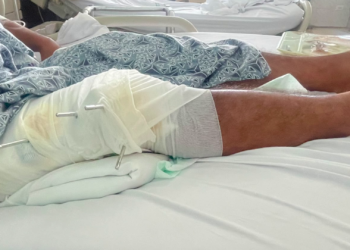 Farmer Says He Was Shot First, Now Faces Charges