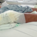 Farmer Says He Was Shot First, Now Faces Charges