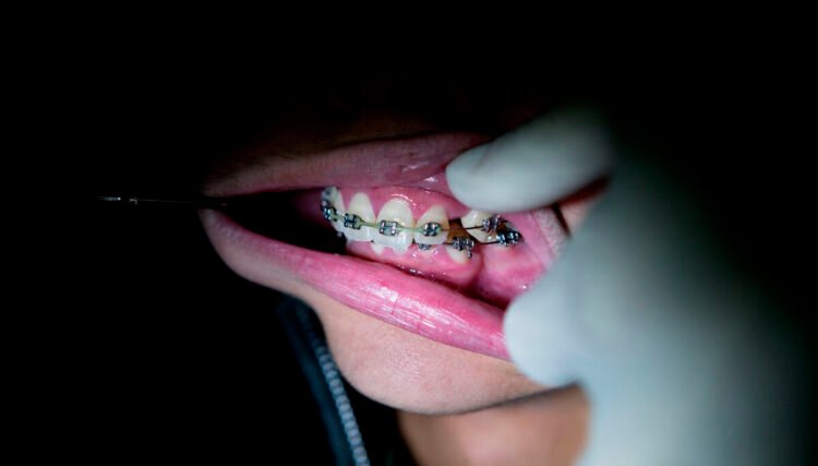 Citizens want orthodontics outside of Nuuk