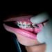 Citizens want orthodontics outside of Nuuk