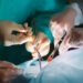 The Ministry of Health launched an investigation after reports of the death of 33 children at the Institute of Heart Surgery