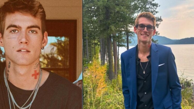 This is how Presley Gerber, son of model Cindy Crawford, who died on Sunday, September 20, changed his appearance due to drugs.