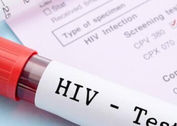 HIV testing surges amid social media discussion | News