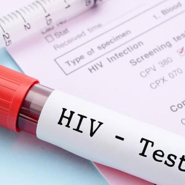 HIV testing surges amid social media discussion | News