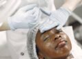 Skin lightening: A reflection of unmet dermatologic need? | Health