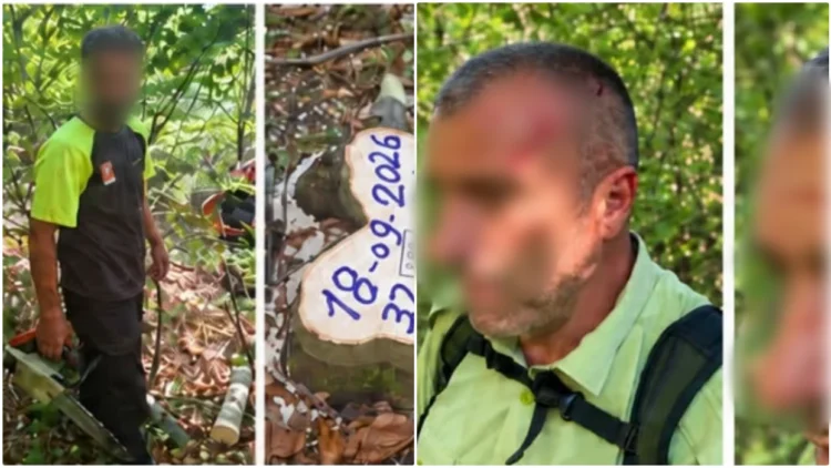 The forest guard in Shtime was physically attacked during the intervention against illegal logging