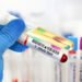 Strict conditions for detecting drug abuse among students – Al-Shorouk Online