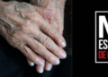 New case of alleged sexual abuse against an adult over 83 years of age causes outrage in Antioquia: they are looking for the alleged aggressor