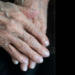 New case of alleged sexual abuse against an adult over 83 years of age causes outrage in Antioquia: they are looking for the alleged aggressor