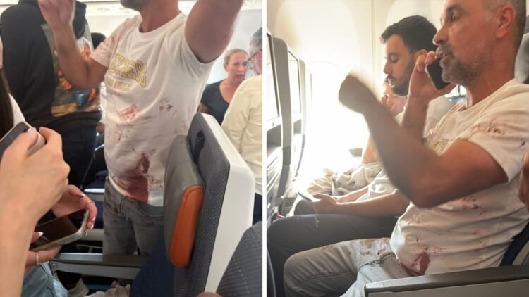 “The plane was going into a nosedive”: the story of the Indian pilot stabbed on the Flydubai flight