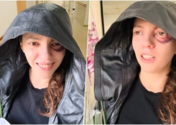 A few days after leaving the hospital, Eva Pango calls for the burning of businesses – Shqip.com