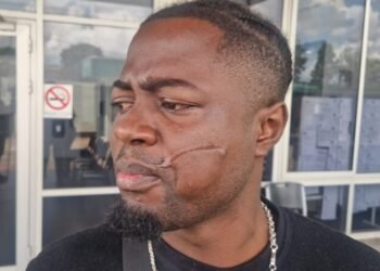 Victim after Kappalani conviction: ‘Four years is not much’ – de True Tijd