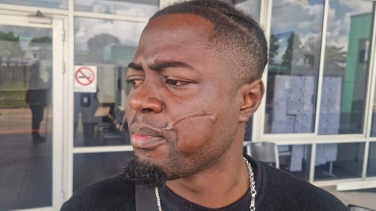 Victim after Kappalani conviction: ‘Four years is not much’ – de True Tijd