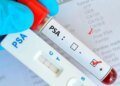 Minsa clarifies that a high PSA does not necessarily mean prostate cancer