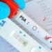 Minsa clarifies that a high PSA does not necessarily mean prostate cancer
